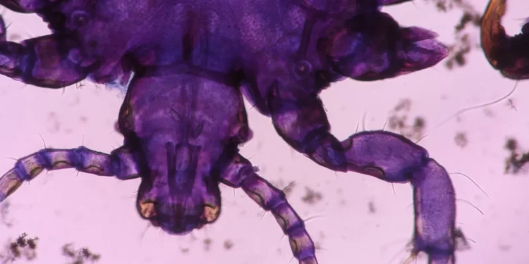 Revisiting the ‘Research Parasite’ Debate in the Age of AI