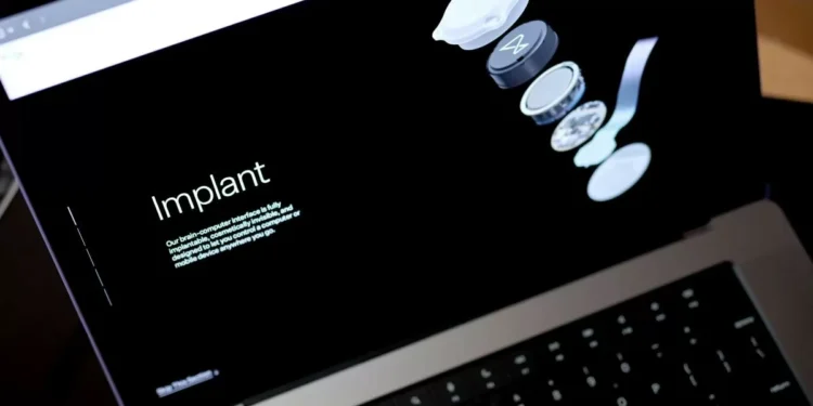 Neuralink Device Helps Monkey See Something That’s Not There