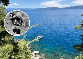 California Resident Catches Plague