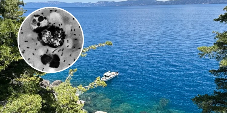 California Resident Catches Plague